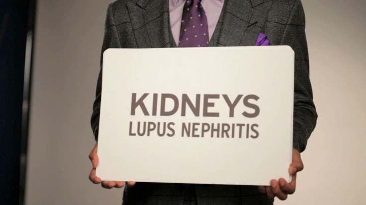 nick-cannon-lupus-spot